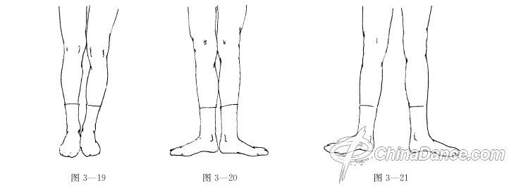 【教師課堂】兒童舞蹈教學 腳位的規(guī)范