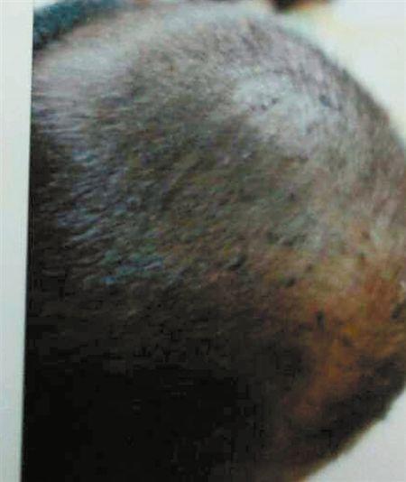 3歲娃被保姆虐待多處留疤 靠譜保姆怎么找